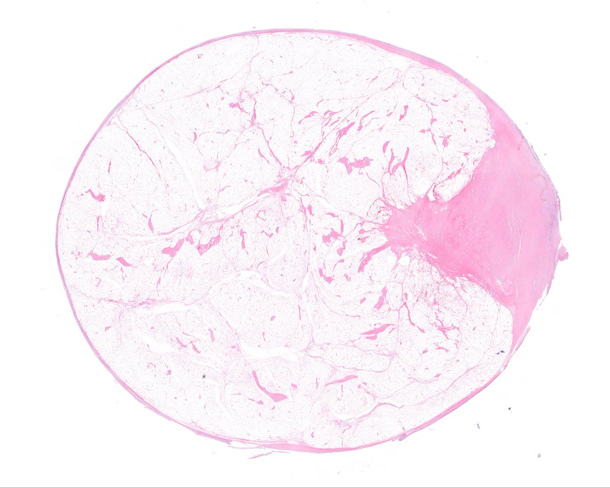 Surgical Pathology Cases tweet media