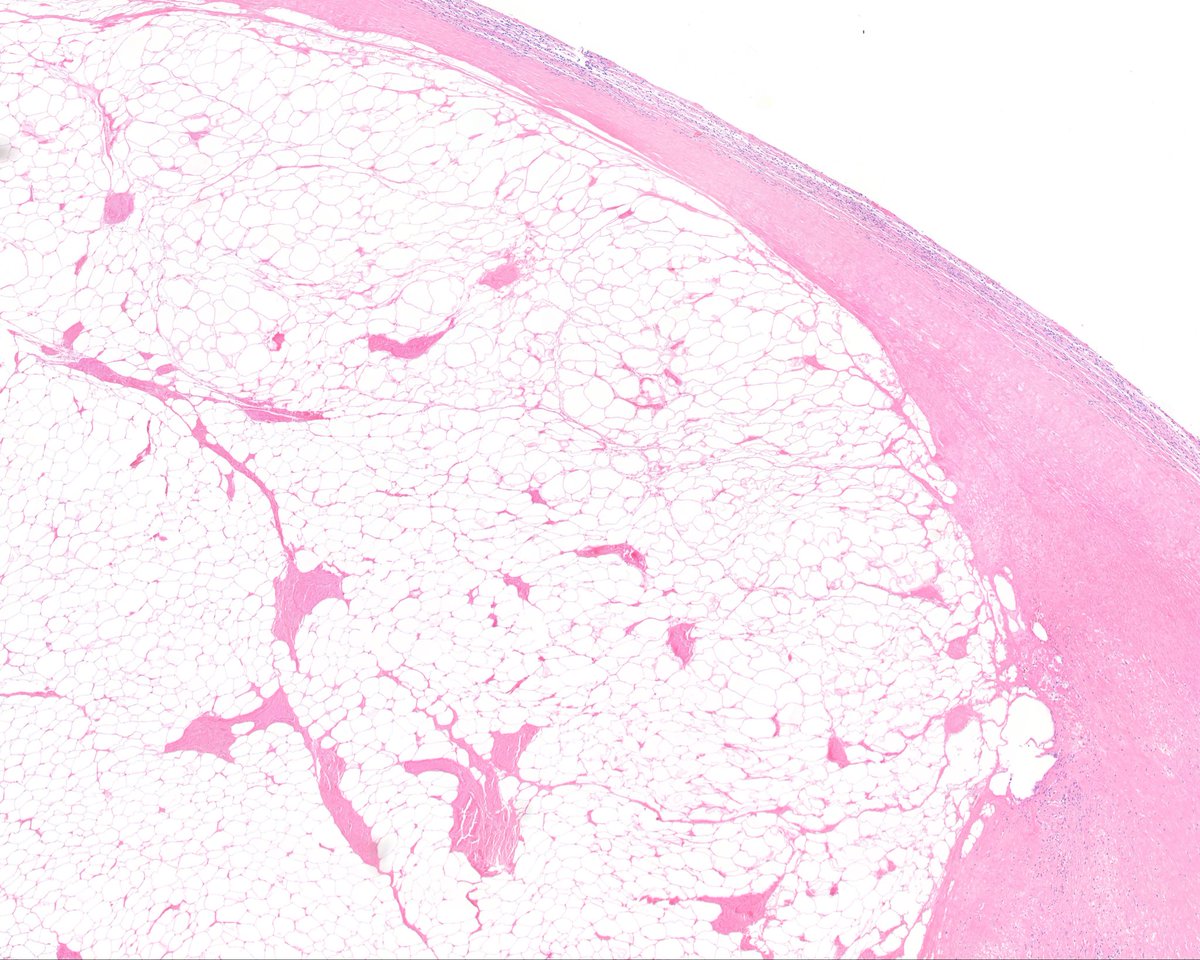 Surgical Pathology Cases tweet media