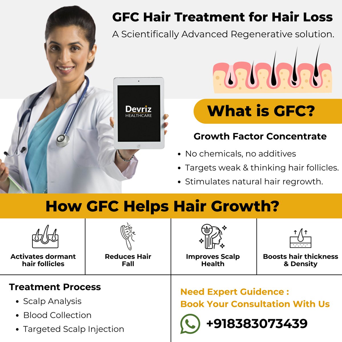 devriz01's tweet photo. Hair fall affecting your confidence?

GFC (Growth Factor Concentrate) Treatment at Devriz Healthcare helps activate dormant follicles, reduce hair fall &amp; boost hair thickness — naturally and safely.
Stronger roots. Healthier scalp. Visible results.
#DevrizHealthcare #GFCTreatment https://t.co/yybmVafPJH