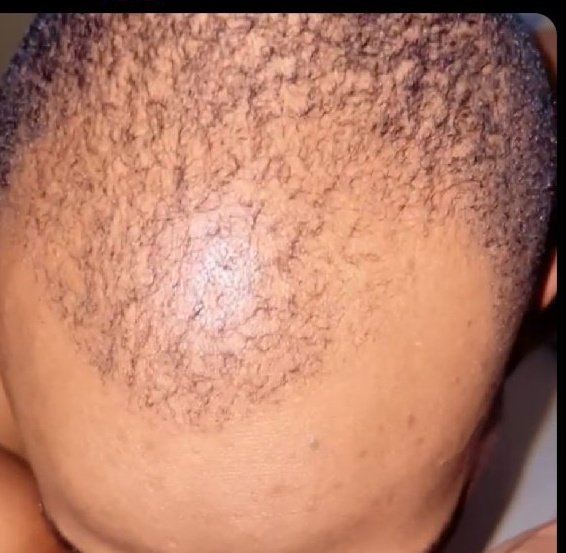 Effects of masturbation, baldness, shrinking dick, MkenyaDaima is really suffering 😥😂