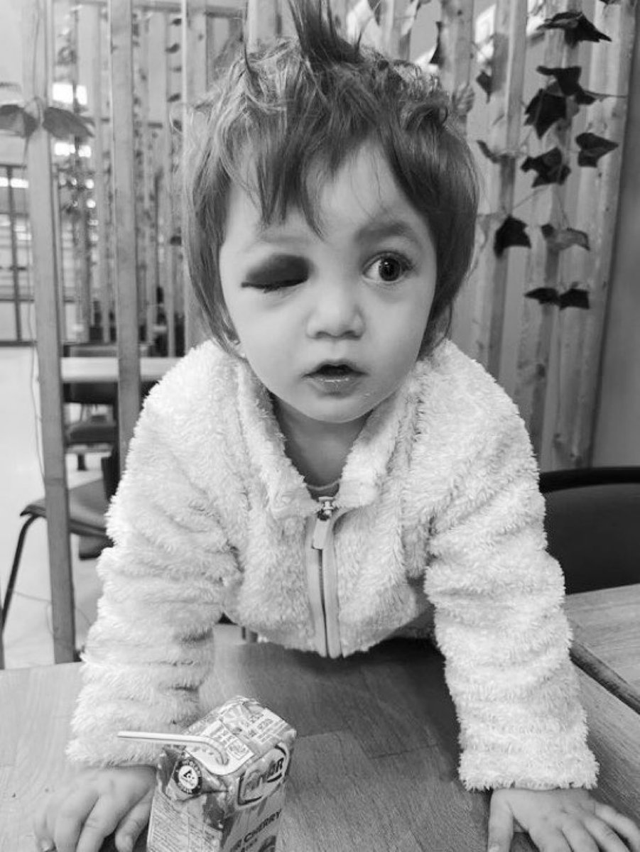 Sokaktaki çocuklarımızı, gençlerimizi katlettikleri yetmedi şimdi de bebeklerimize saldırmaya başladılar. 

Allah düşmanın da şereflisini versin.