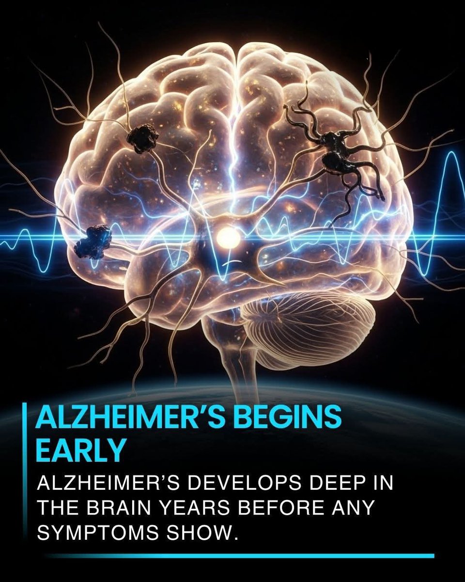 NextScience's tweet photo. 🚨 Alzheimer’s disease doesn’t appear overnight, its development begins deep in the brain many years before any noticeable symptoms emerge. Damage starts silently in regions responsible for memory and cognition, gradually building up over time.

This early progression explains why interventions in the initial stages are so critical. Detecting Alzheimer’s before symptoms appear could allow for treatments that slow or prevent the disease from advancing, potentially preserving memory and brain function for longer.

Understanding that Alzheimer’s starts decades before diagnosis highlights the importance of brain-healthy habits, regular check-ups, and ongoing research. Early awareness and prevention strategies could change the trajectory of this widespread neurodegenerative condition.