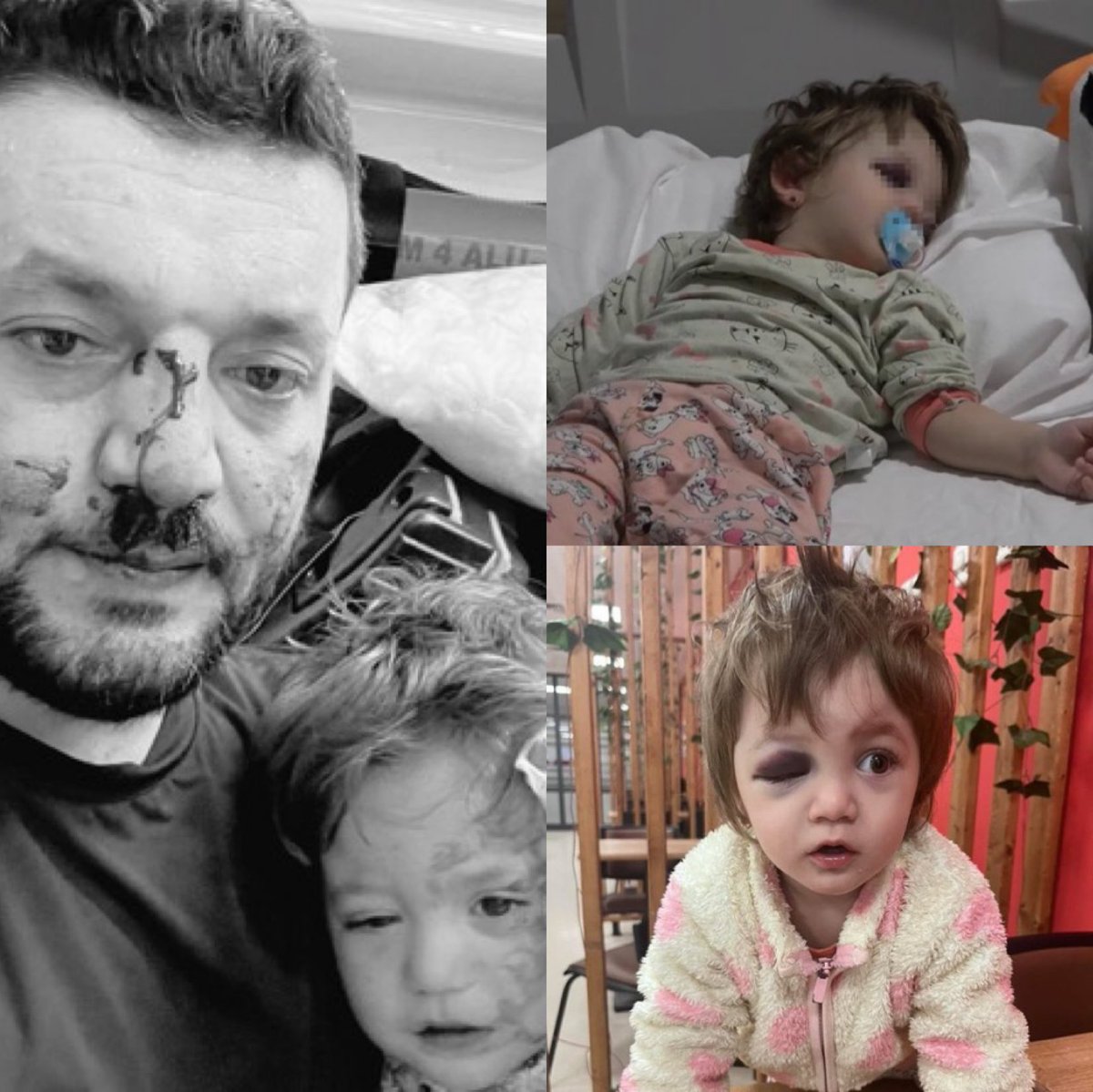 Bu olay hakkında konuşan vekiller oldu mu? Bu aile Türk diye mi kimse konuşmuyor?
Bu ülkede Türk sorunu vardır ve bu konuyu dile getirmeyen hiçbir siyasi partiye oy vermeyeceğim!
Bu olayı duyuran partiler de bunu sıradan bir kavga olarak duyurmayacak AŞİRET detayını vurgulayacak