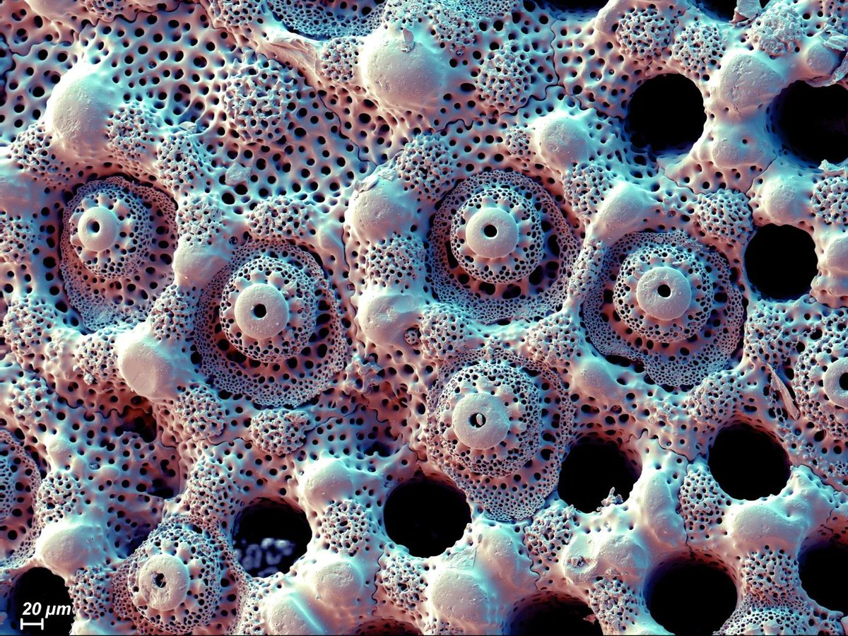 BigBangSciCom's tweet image. Détails de test d'oursins vus au #microscope électronique à balayage

Crédits : Stephan Borensztajn et Caroline Thaler

#animals #naturelovers #SVT #imagerie #MEB #SEM