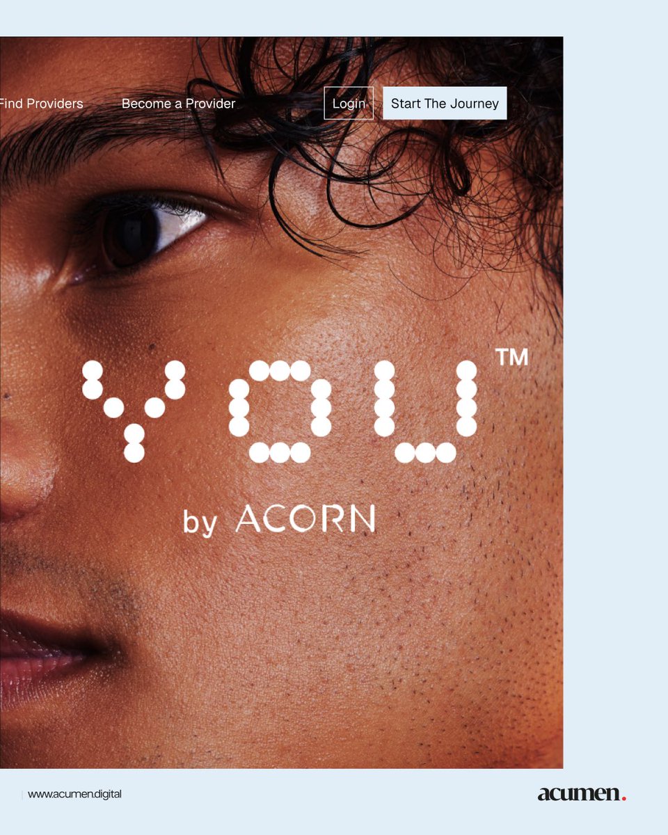 When science meets intentional design.

For ACORN, we crafted a digital ecosystem that mirrors their mission: personalized, intelligent, and future-ready.
- Clear storytelling.
- Seamless navigation.
- A structure built to carry innovation.

A thread 👇🏼