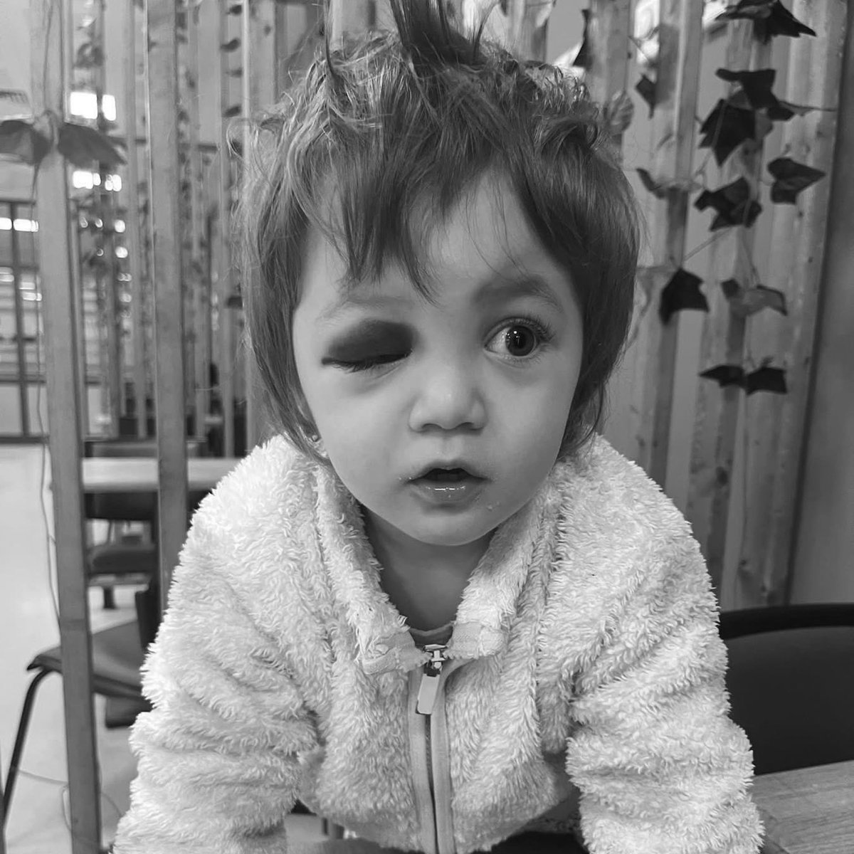 PKK’nın dağ kadrosunun kalleş saldırısında, 11 aylık Bedirhan Bebek şehit edilmişti.

PKK’nın şehir yapılanması tarafından Yalova'da saldırıya uğrayan 14 aylık İkra bebek ise başına aldığı odun darbesine rağmen çok şükür hayatta.

Terörün hedefi değişmiyor: Masumlar.