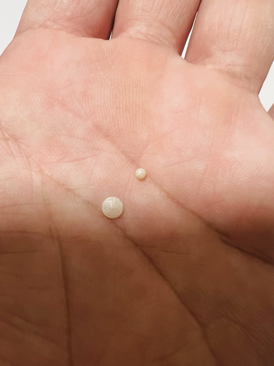 鍋食べてらスーパーで買ったホタテから真珠出てきた😳
しかも2個‼️

ホタテから真珠出てくる可能性って20万分の1なんだって🥹

こんな所で運使いたくなかった😇