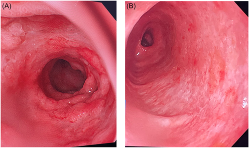 JPGN Reports tweet media
