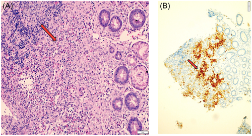JPGN Reports tweet media