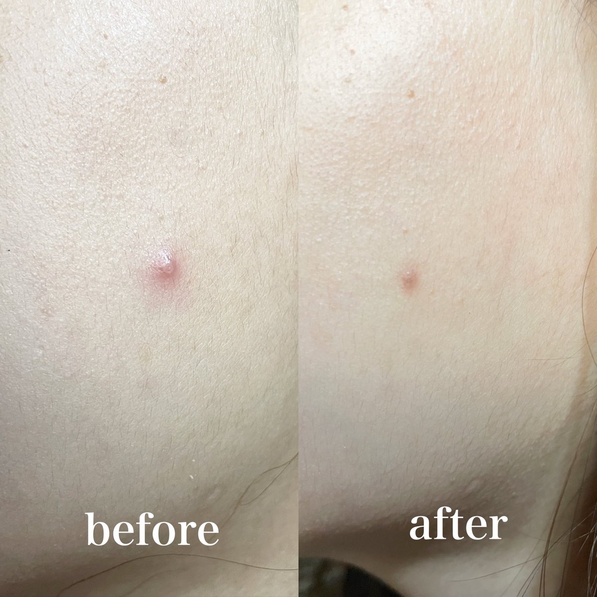 asya ☆⋆。𖦹°‧★ tweet media