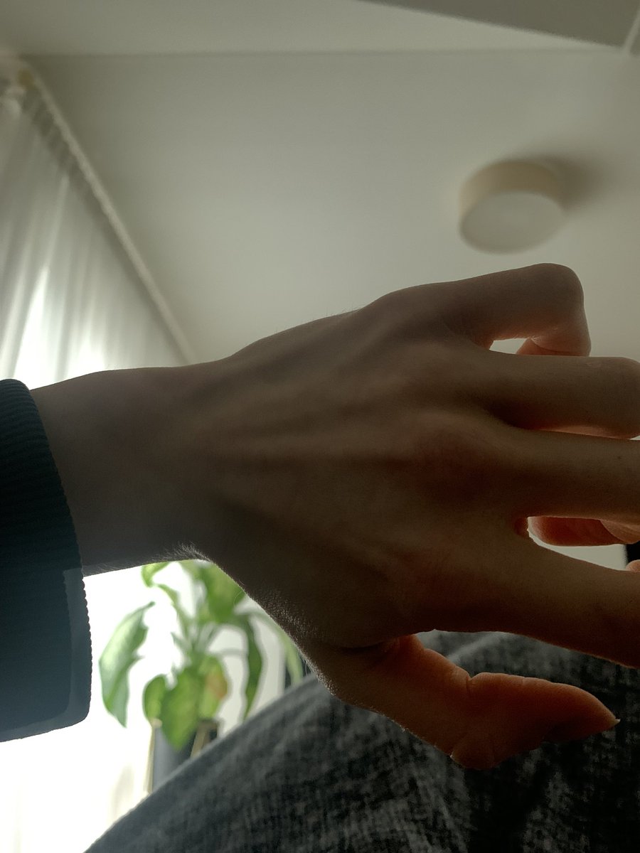 diaryojo's tweet photo. #handcheck at my grandparents #yup i am #normal https://t.co/Aji7mtXykx