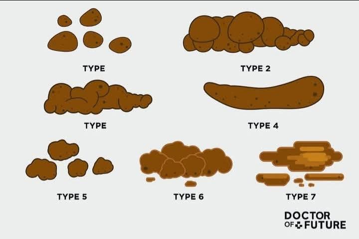 WHAT NORMAL SH!T SHOULD LOOK LIKE
(AKA: The Royal Standard of Poop. Because your gut deserves royalty.)

1. Shape:
Your poop should look like a smooth sausage or snake.
Not goat droppings. Not mashed yam.
– If it’s hard and cracked: you’re constipated.
– If it’s too soft or