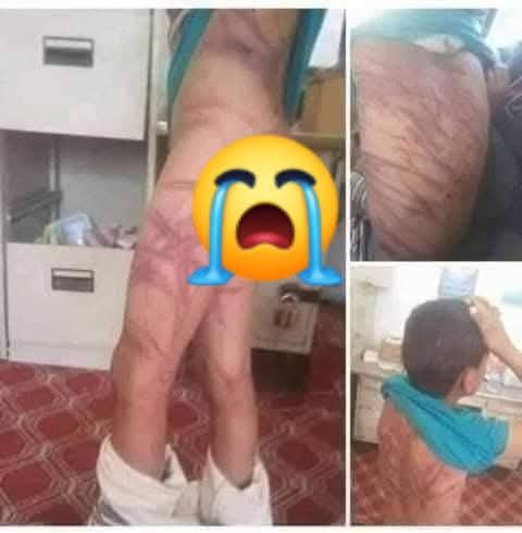 مولویوں پر بھونکنے والو ایک نظر ادھر بھی ہوجائے یہ کسی مدرسے کے استاد کا تشدد نہیں🫵
 بلکہ ایک سکول ٹیچر کے تشدد کا نشانہ بنا اور دنیا کو الوداع کہہ گیا😢😡👇