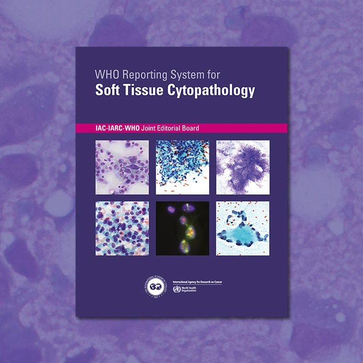 IARCWHO's tweet image. The @WHO Reporting System for Soft Tissue Cytopathology is now available in print format.
This is the 4th volume of the new series of reporting systems for cytopathology, which is a joint project of IARC and @IACytology.
For more info about the book, see
iarc.who.int/news-events/pu…