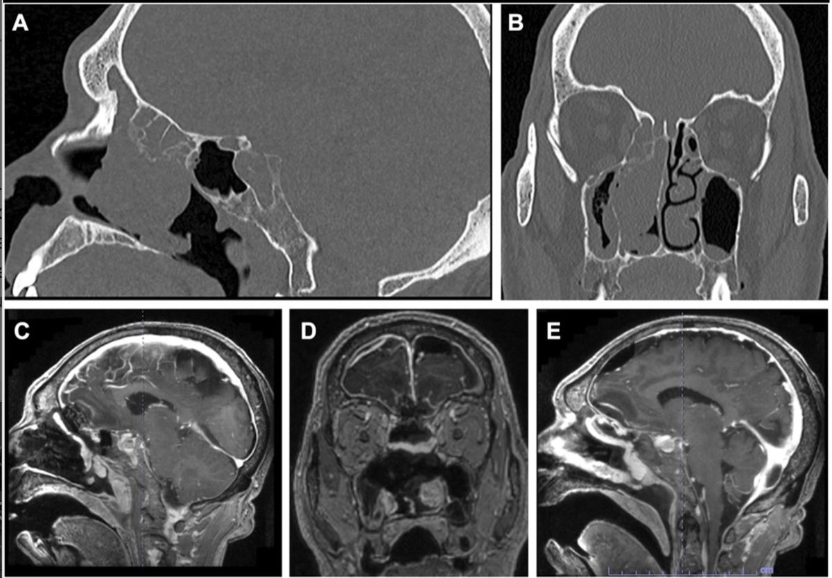 Neurosurgery Publications tweet media