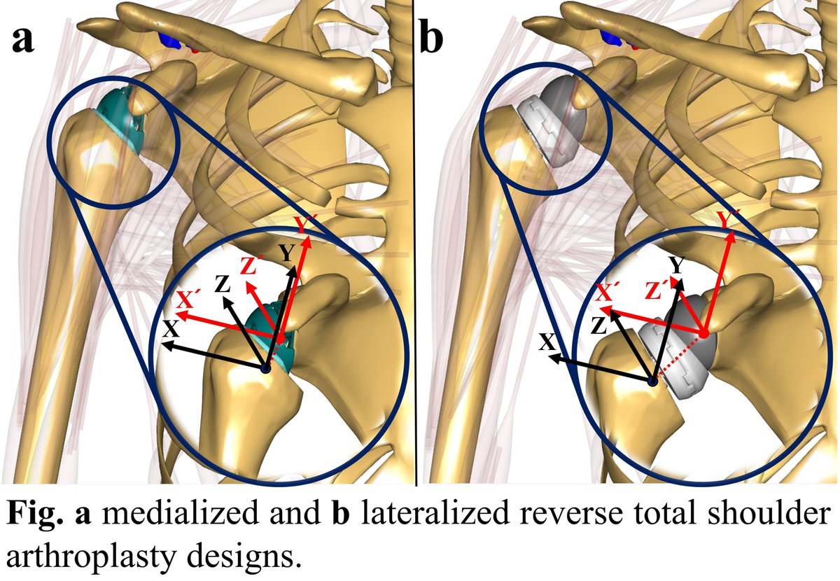 AnyBodyTechnology tweet media