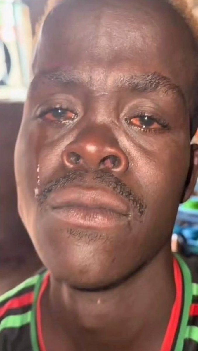 Lilson 🫂 tweet media