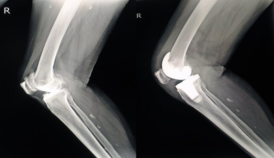 LeonardLegal's tweet photo. Leonard Legal Group represents people injured by unsafe or defective medical and healthcare products, from hip and knee implants to talcum powder and surgical devices. We've got nearly 30 years of experience in this practice, and we are ready to help! https://t.co/CEiOHiWjUE https://t.co/KG1tFkqgGh