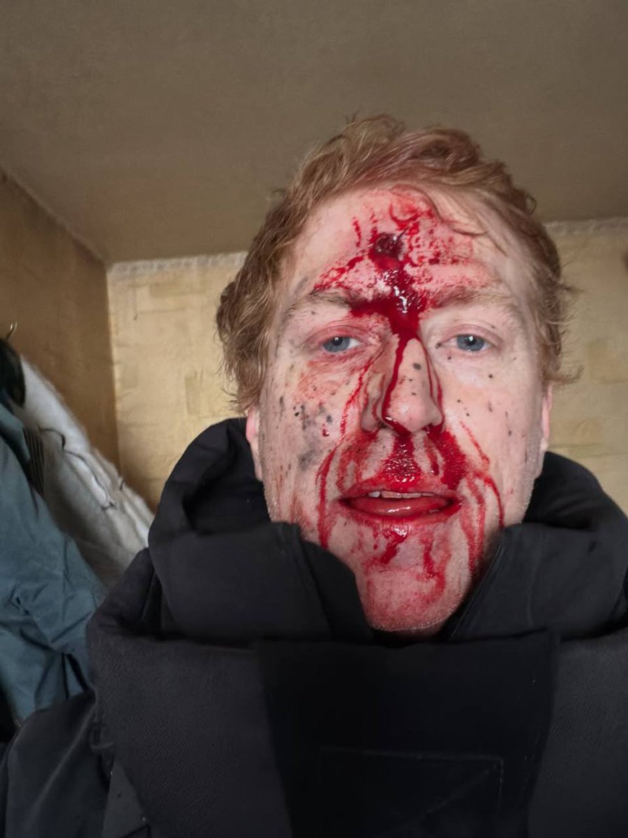 🤬 Russians attacked an evacuation car in the Kharkiv region. Denys Khristov was injured.