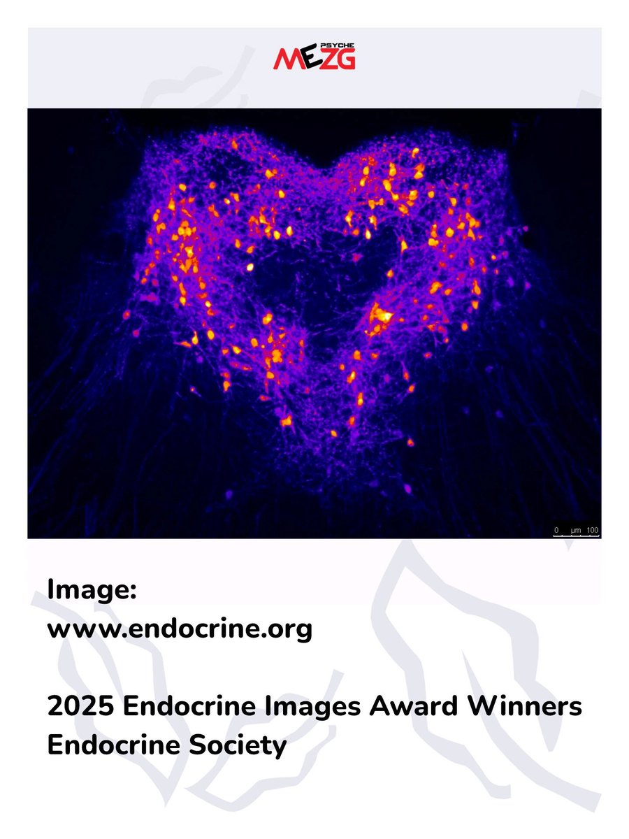 Psyche:Mezg tweet media