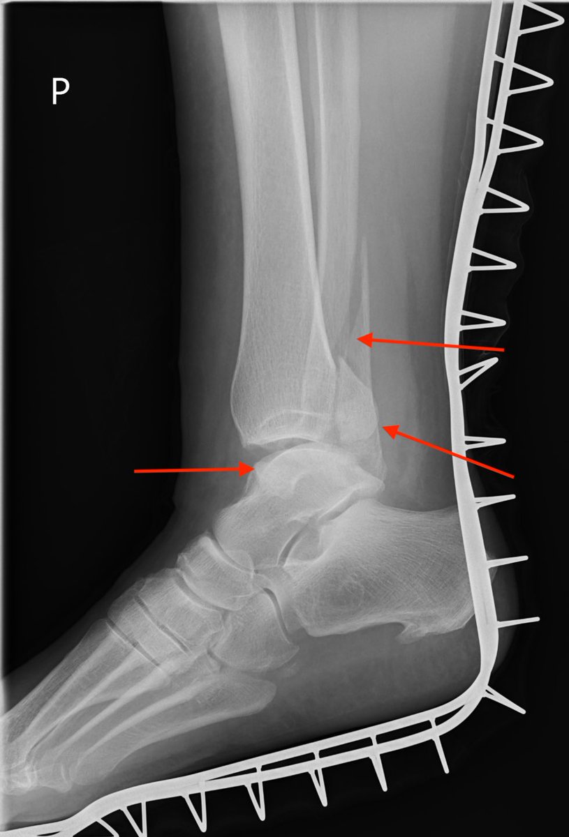 Władysław Krajewski tweet media