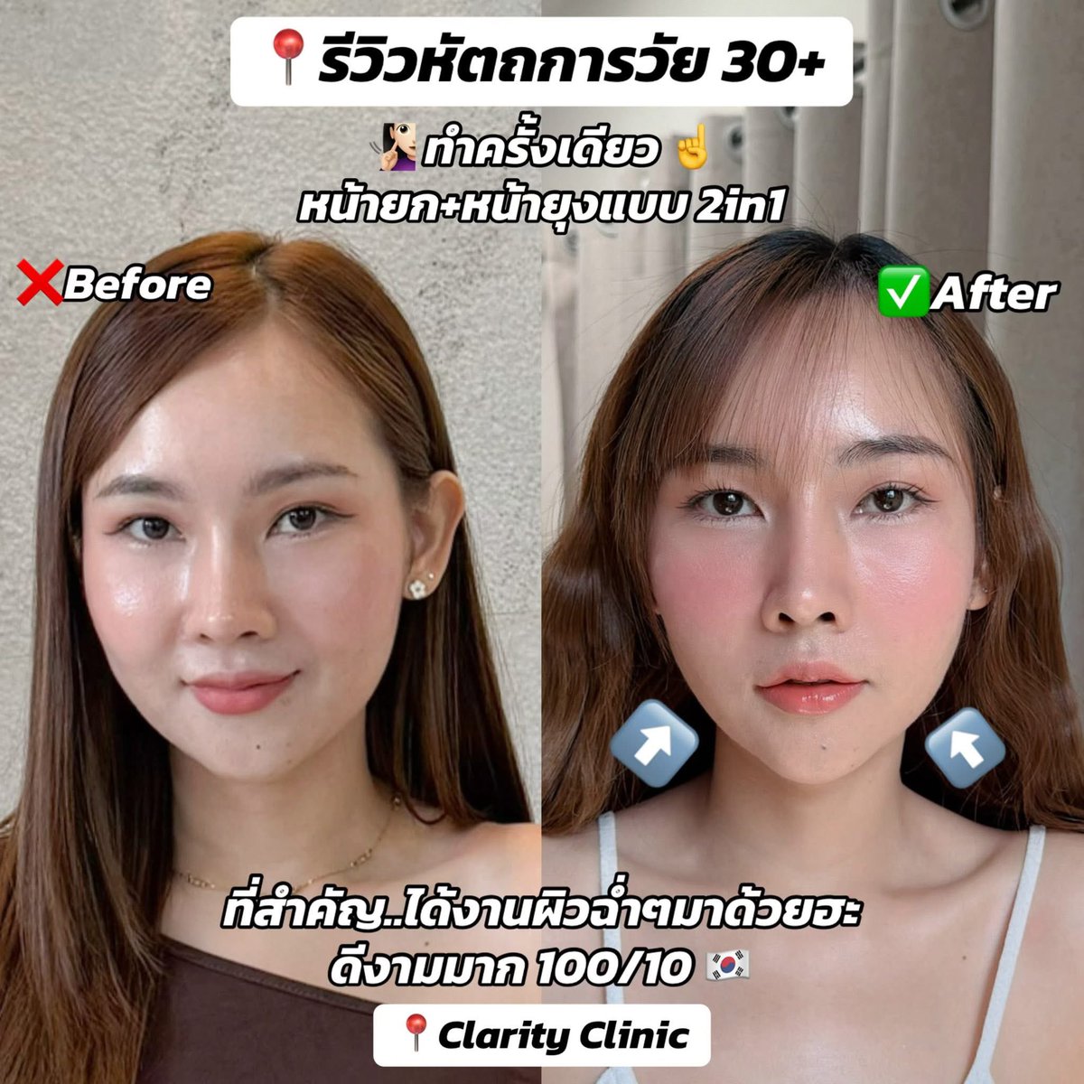 ฝ้าย FaiiJanji tweet media