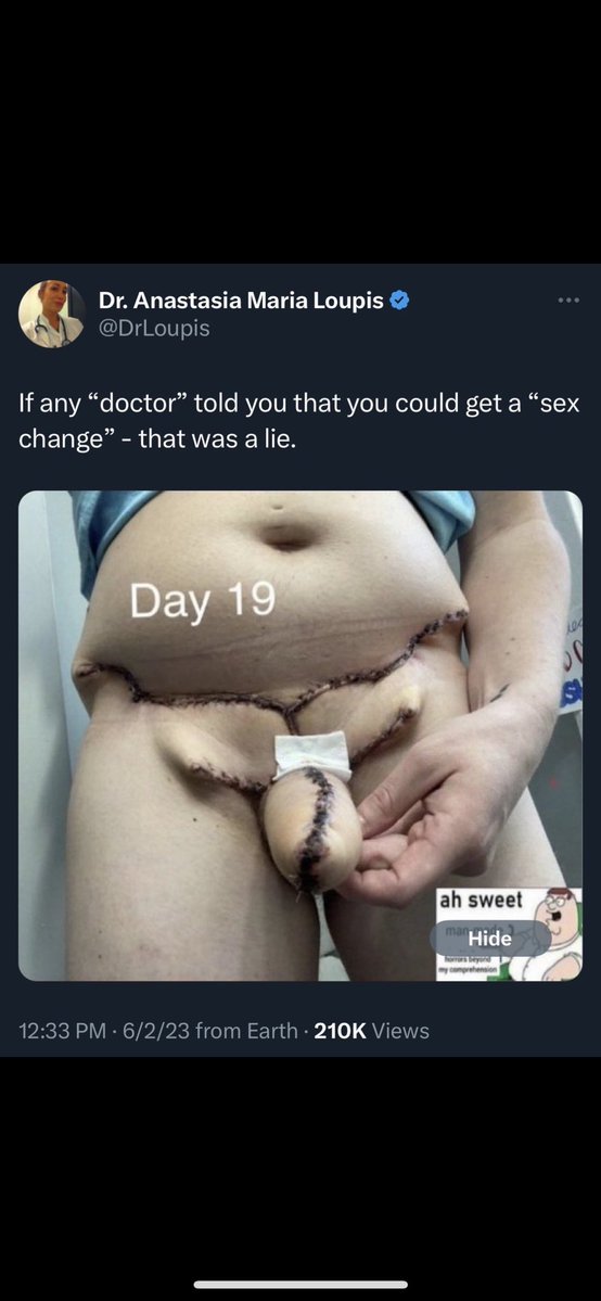 Alright, goreposting #1:
Ein Frauenpenoid (post op) (NSFL)