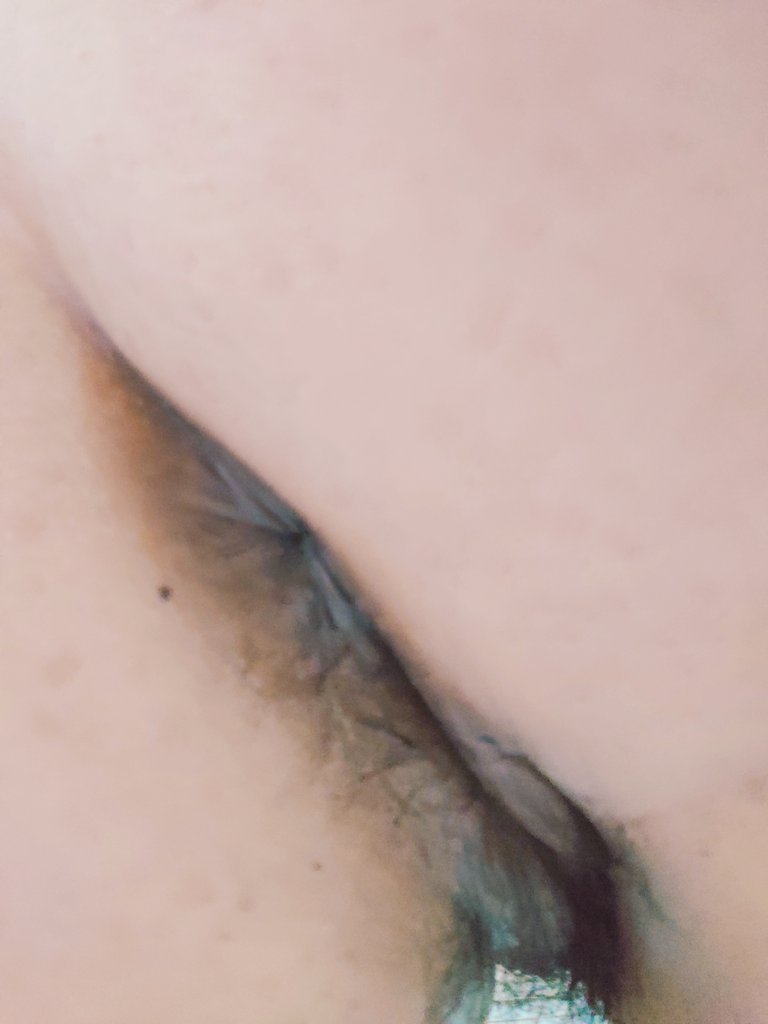 皮皮擴張ℹ️🆖 tweet media