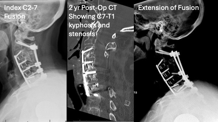 Cervical Spine Research Society tweet media