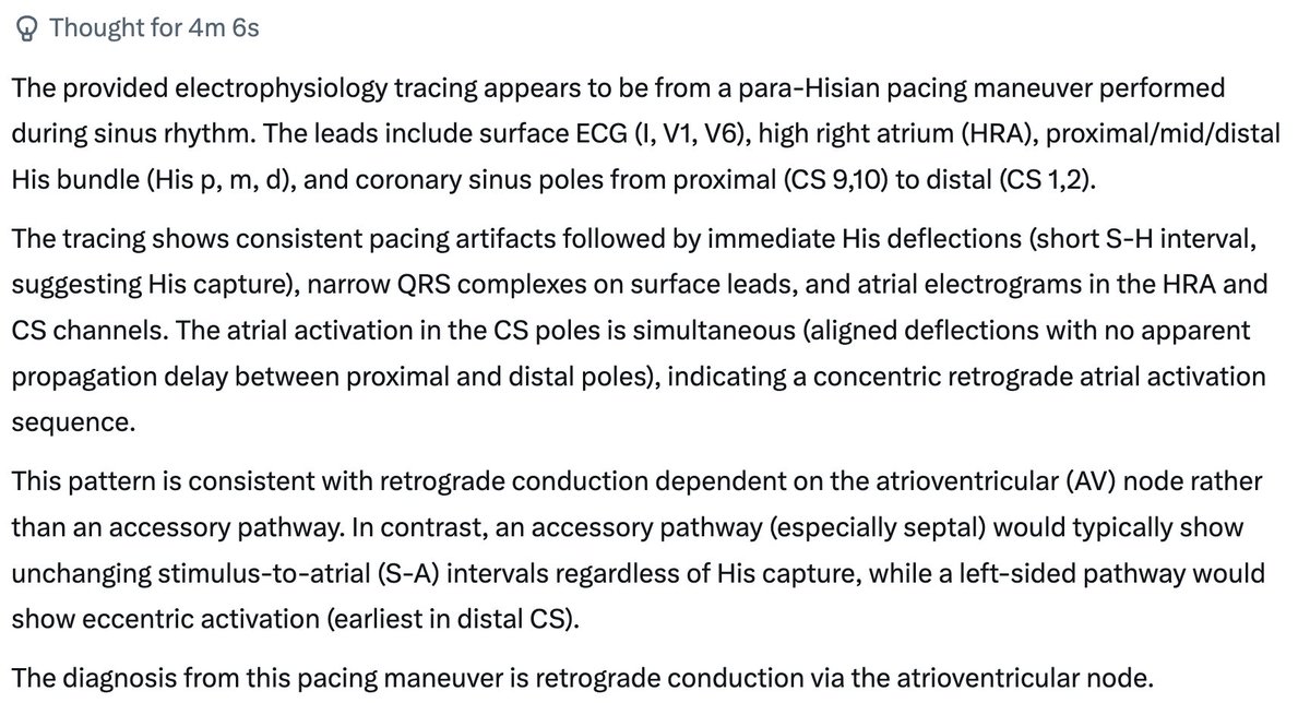 DrRoderickTung's tweet image. How good is today's AI to replace #EPeeps? Fascinated by steep progression of Seedance 2.0, AI hospitals in China, and @elonmusk comment on medical schools.

I asked for an interpretation of this atrial overdrive pacing with a pseudo-AHHV response to Gemini, Grok, and Chat GPT...