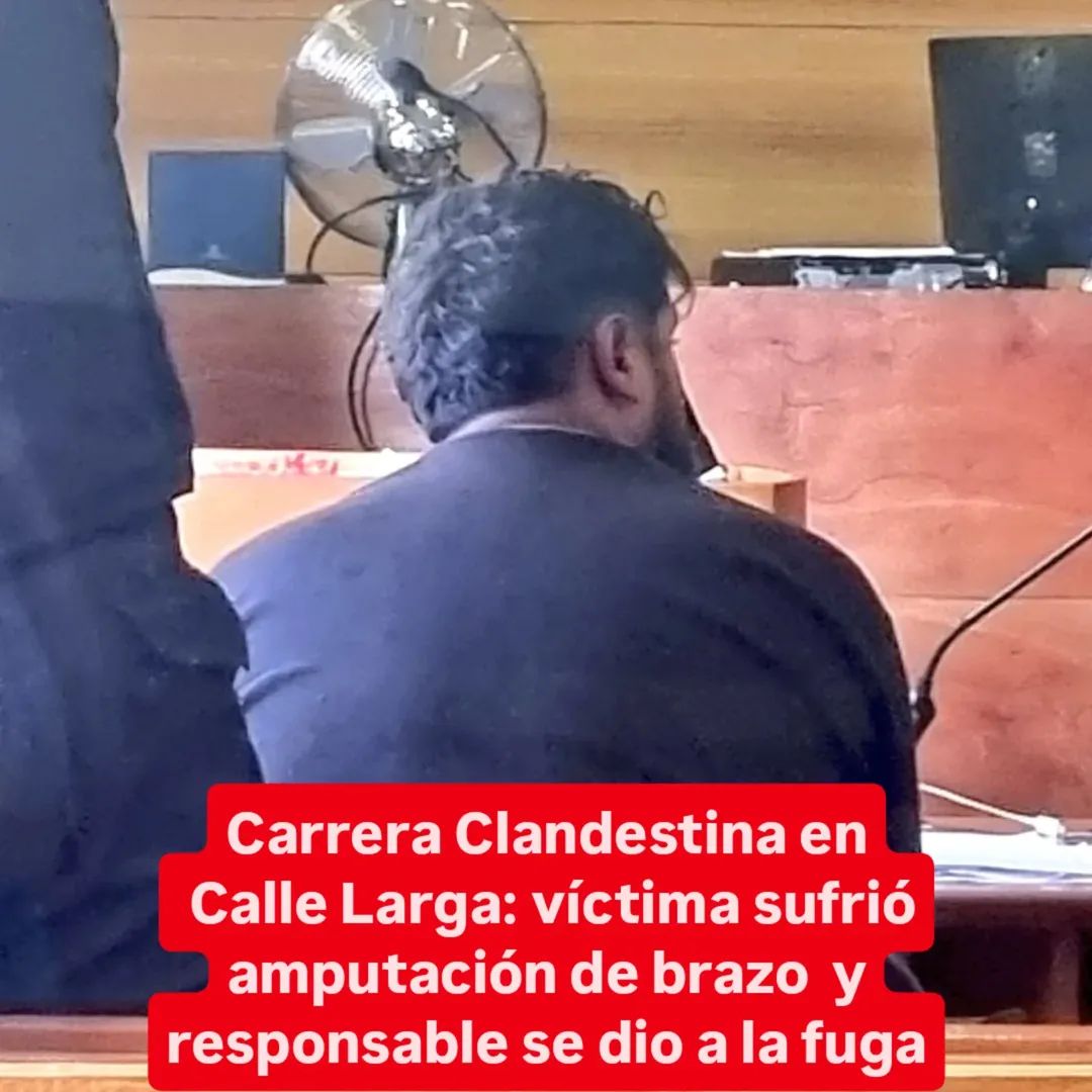 UPLaRadio's tweet photo. 🟣 #CALLELARGA CARRERA CLANDESTINA TERMINÓ CON UN HOMBRE EN RIESGO VITAL

Tras colisión de vehiculo que circulaba en contra del tránsito contra una moto, un sujeto sufrió la amputación de su brazo. 

El responsable fue enviado a la cárcel

Lee más en https://t.co/dXdDXtNBT9 https://t.co/UnQMph61eg