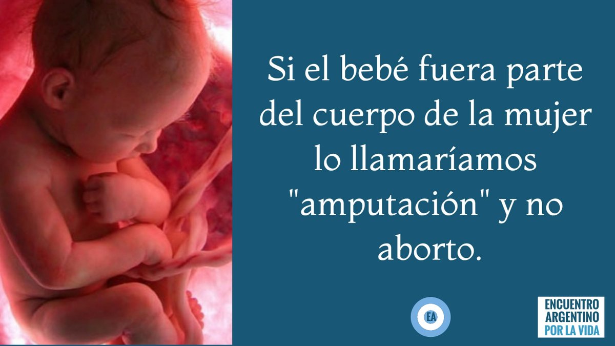 EA_EncArg's tweet photo. #EncuentroArgentino #GeneracionProvida #NiUnPasoAtras https://t.co/I7t8i0LgAn