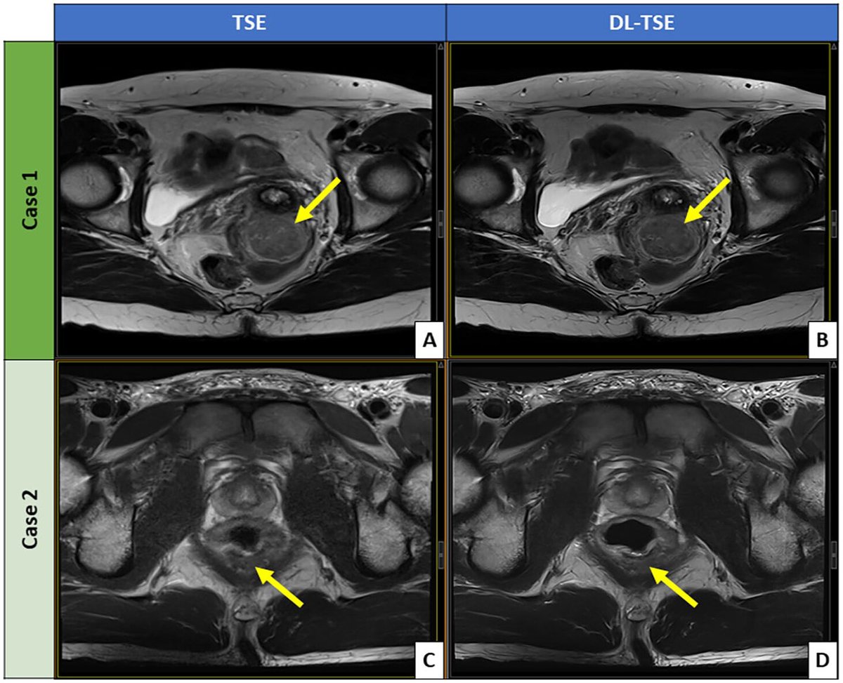 Canadian Association of Radiologists Journal tweet media