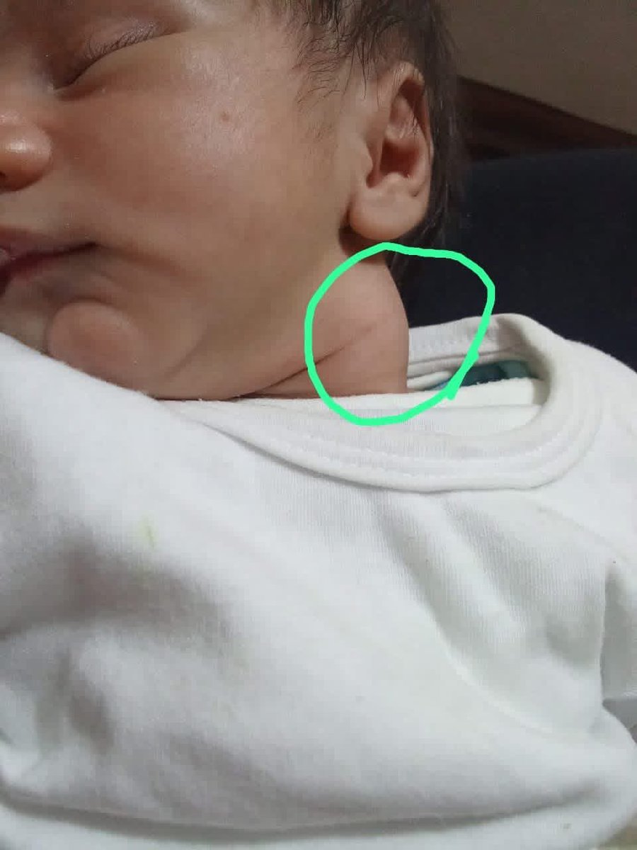 I WILL DIE😭 

Unfortunately, my poor little my daughter  body is full of pimples and I can't do anything for her. She urgently needs your help to provide tr

3 replies — even dots — can break the
 algorithm😭

gofund.me/62fb9062d