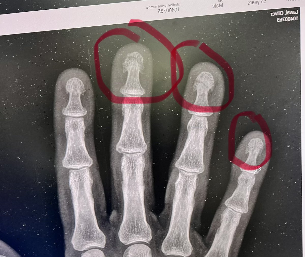 Oliver Lawal tweet media