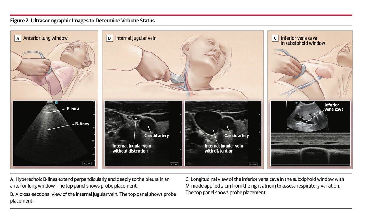 Oliverio tweet media