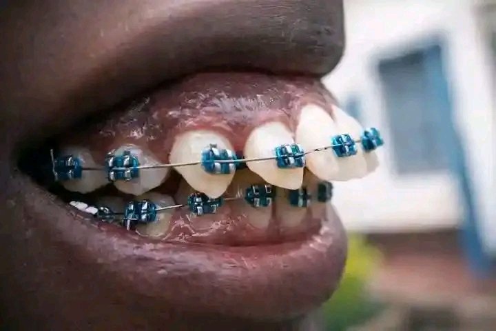 Hii nayo hata teke haiwezi rudisha ndani 😅😅