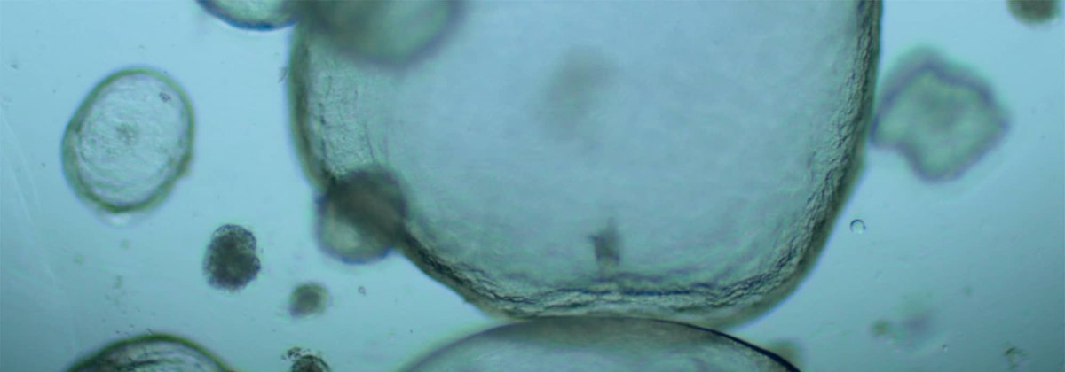 GIS IBiSA tweet media