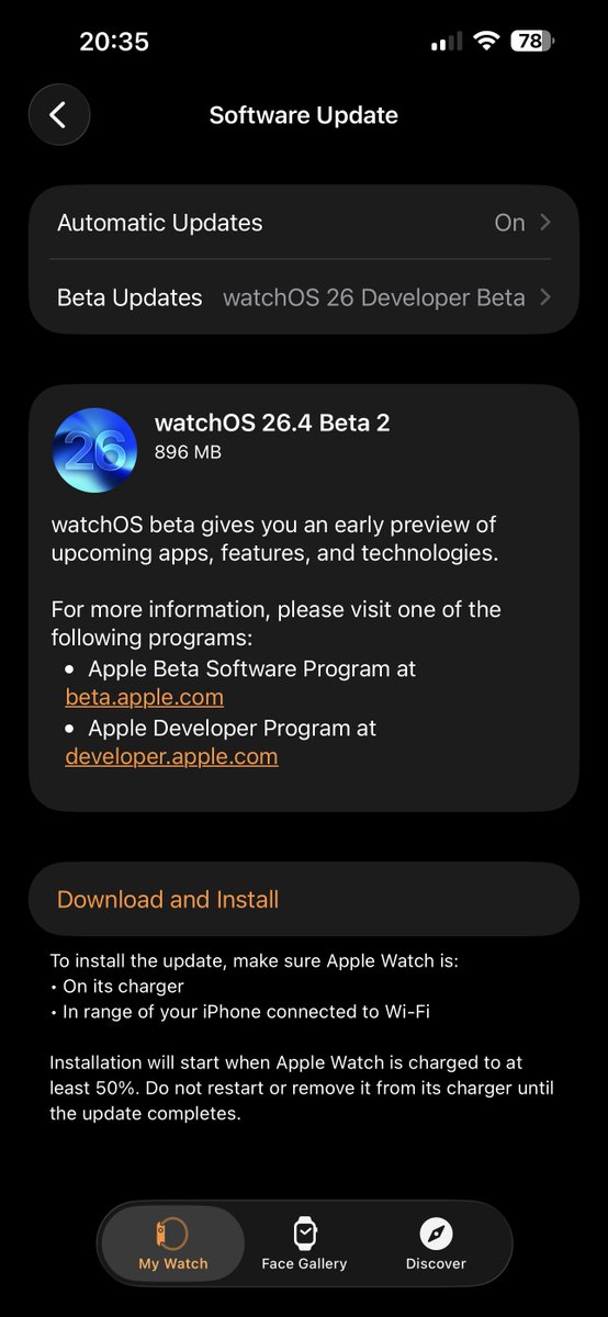 iSWUpdates's tweet photo. watchOS 26.4 Developer Beta 2 (23T5221e) has been released. https://t.co/XypIlJSJG5
