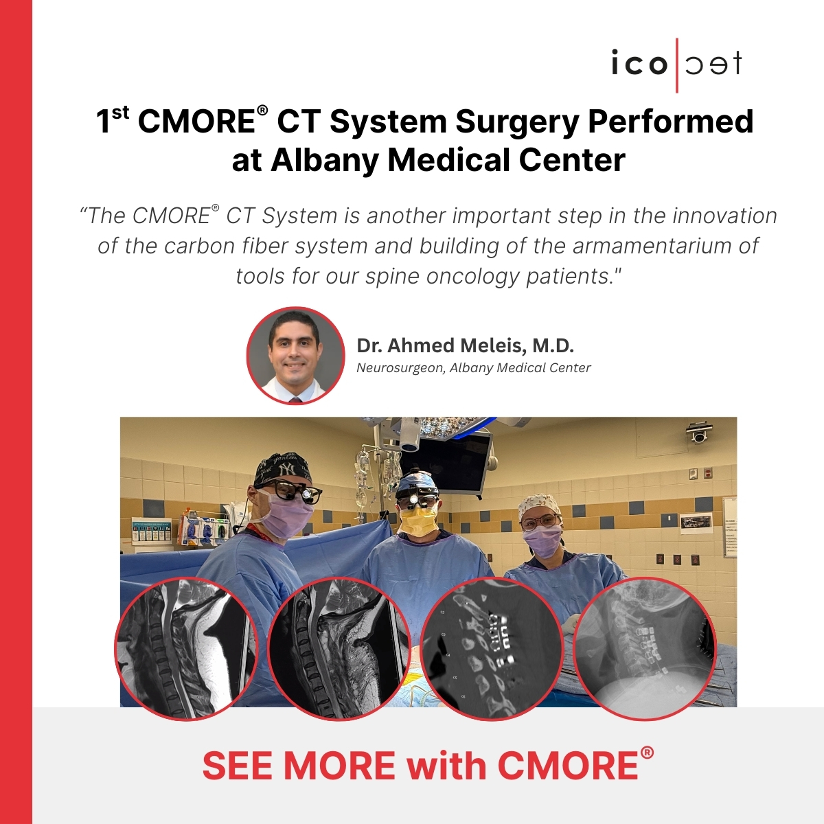 icotec Medical tweet media