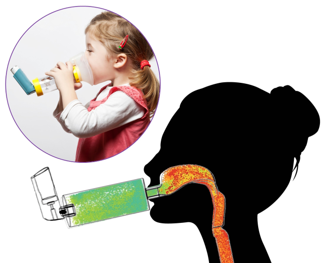 Educators, bring cutting-edge biomedical engineering into your classroom with this Ansys Education Resource, transforming complex respiratory drug delivery into an engaging, hands-on learning experience. bit.ly/4rI60Oz