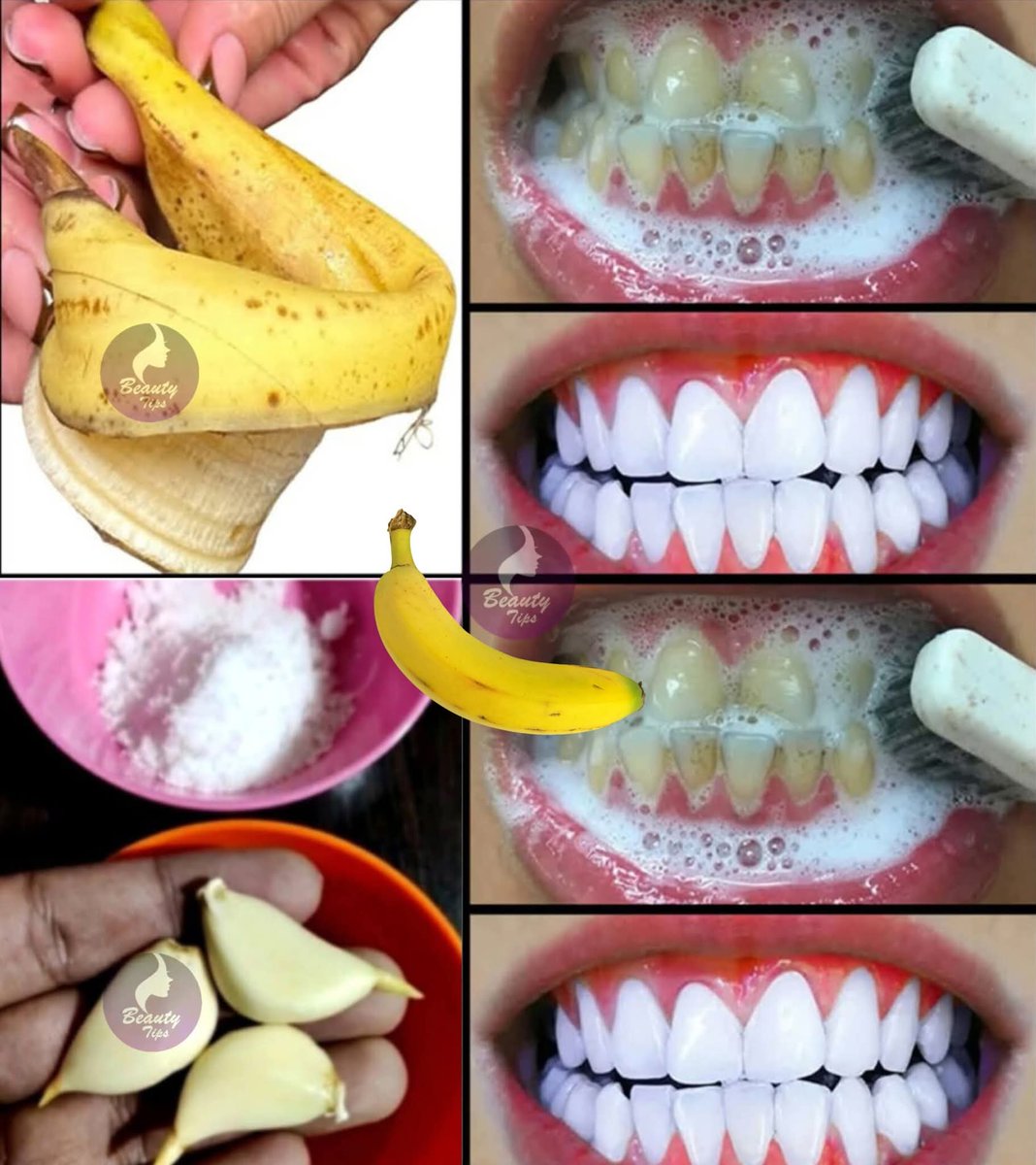 mushatsi_isla's tweet image. Teeth whitening at home in 3 minutes || to naturally whiten your yellow teeth || 100% effective #teethwhitening