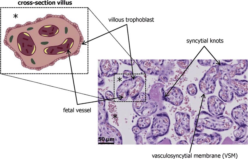 Pathology Interest Group | باثِج tweet media