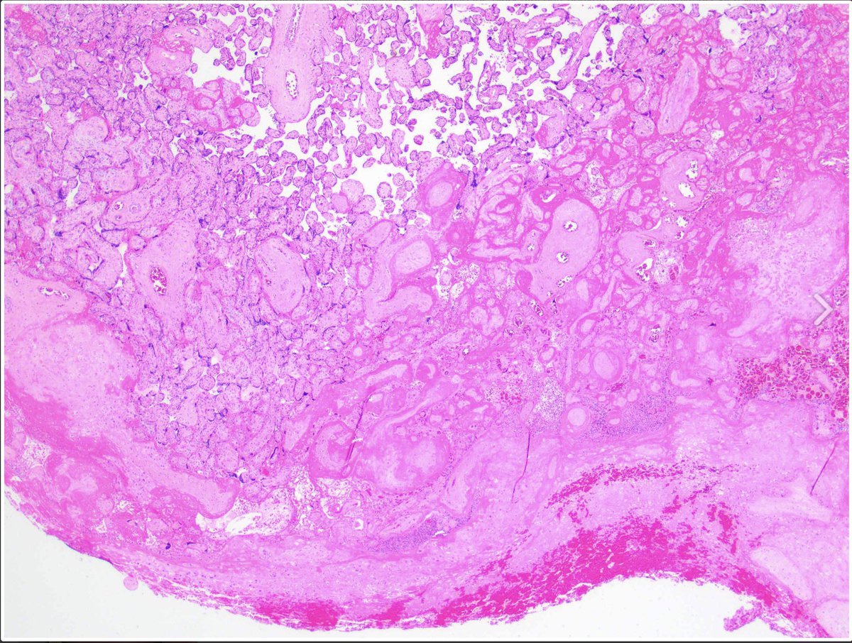 Pathology Interest Group | باثِج tweet media