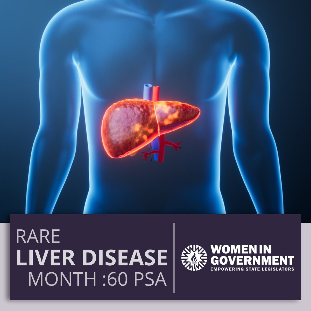 WomenInGovt's tweet photo. Did you know February is Rare Liver Disease Month? Women In Government is proudly distributing Public Service Announcements throughout the country this month to encourage you to stay #RareAware! Take a listen and access relevant resources today: https://t.co/icLjIzvfVx https://t.co/KJDmIpfLwq
