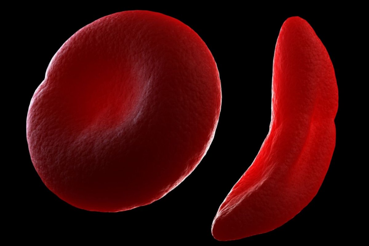 Parmita Mishra tweet media