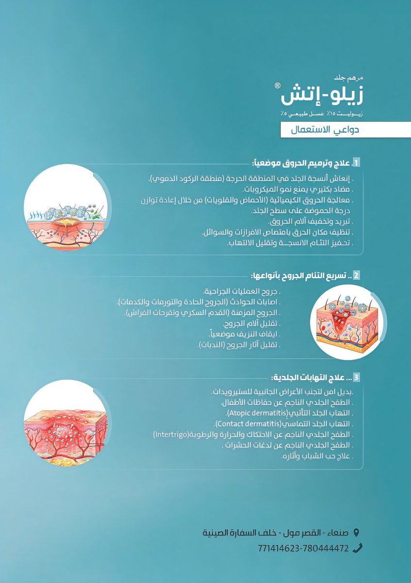 Yemenieconomy's tweet photo. صنع في اليمن
( زيلو - إتش ) منتج دوائي محلي الصنع مرخص رسمياً، هذا المنتج يمثل إنجاز وطني في مجال التصنيع الدوائي وتعزيز الاكتفاء الذاتي.
المنتج عبارة عن مرهـ ـم موضعي مضـ ـاد بكتـ ـيري يُستخدم للمساعدة في عـ ـلاج الحـ ـروق والجـ ـروح وتسريع التئامها من خلال الحد من نمو البكتـ ـيريا وتقليل خطـ ـر العـ ـدوى
تم تطويره وفق أسس علمية دقيقة وخضع للفحوصات والدراسات اللازمة، وحصل على الترخيص الرسمي بعد استيفاء معايير الجودة والسلامة المعتمدة.
 
الجمهورية اليمنية - صنعاء
 تلفون: 780444472 - 771414623

#معا_لدعم_المنتج_الوطني