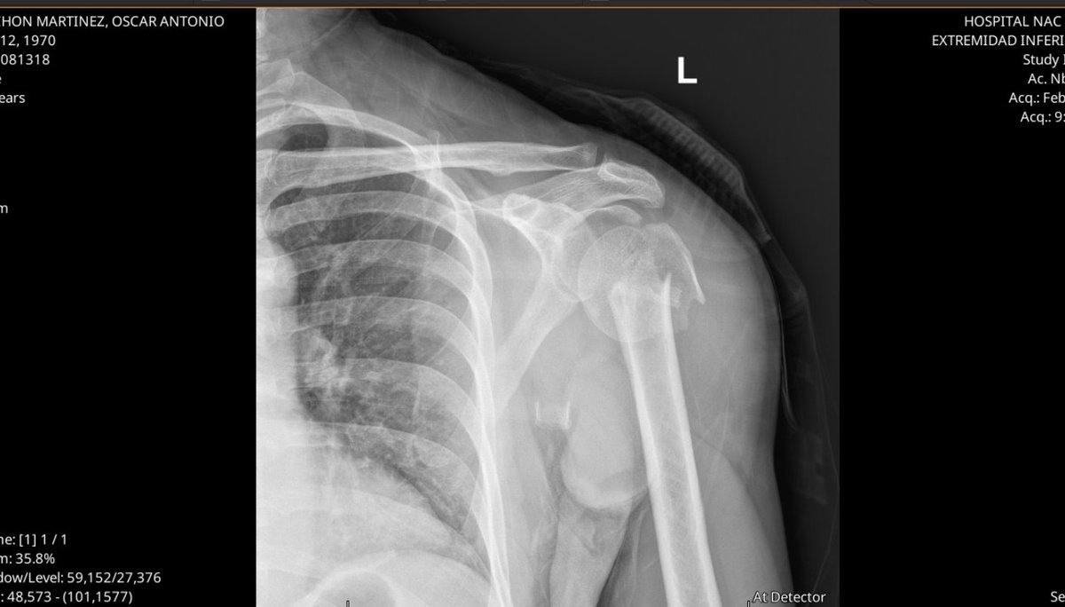 Oscar Machon tweet media