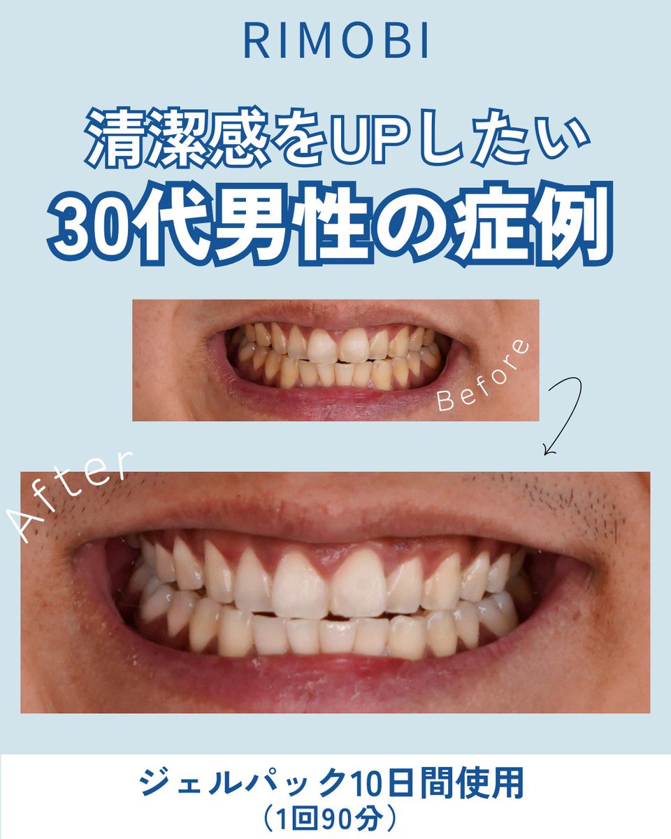 RIMOBI(リモビ)｜DENNOVATE(ディノベート)取扱 (@rimobi_dental