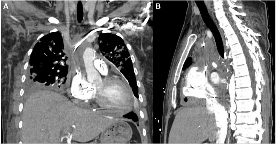 Circ: Heart Failure tweet media